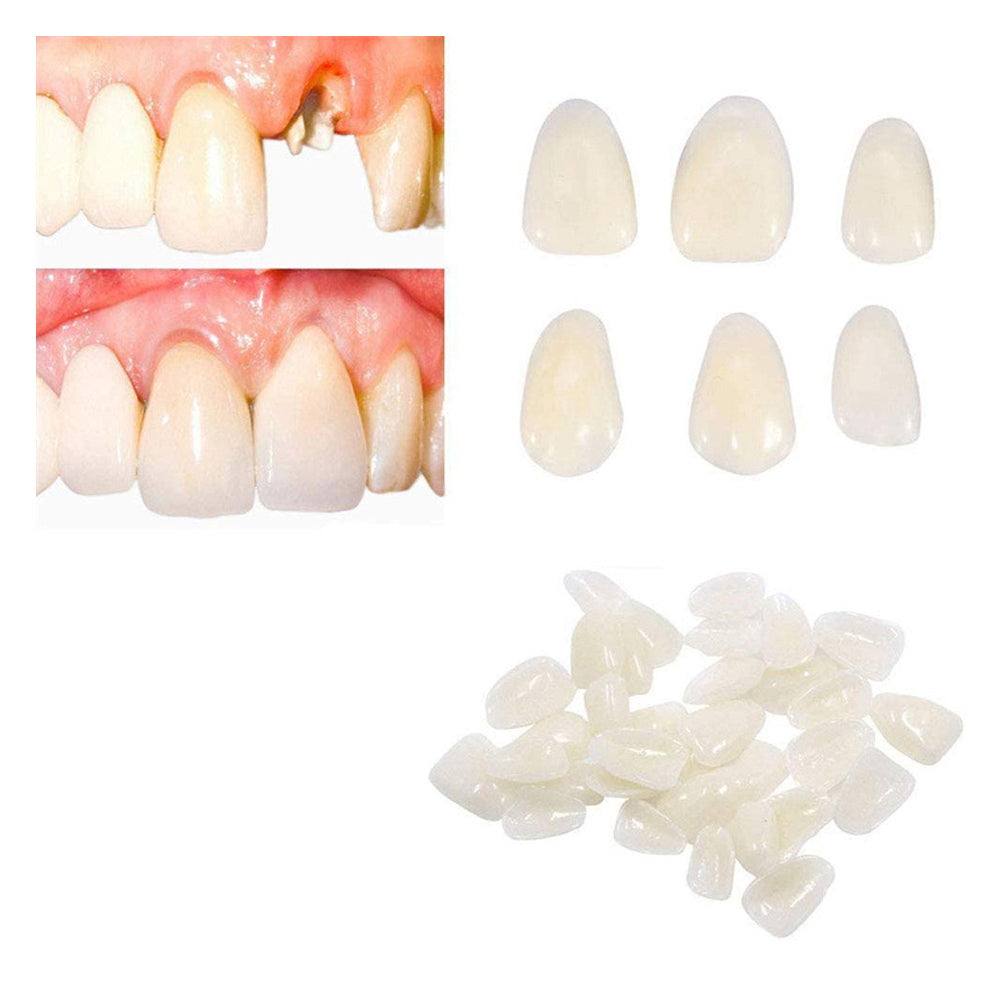 1 Box Dental Temporary Teeth Crown Veneers Kit for Molar Posterior Teeth