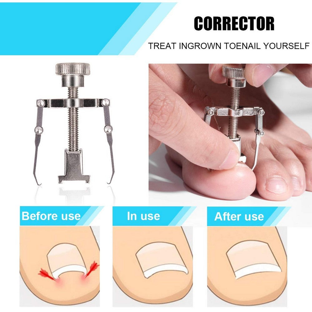 7PCS Private Stainless Steel Ingrown Toenail Tools Kit